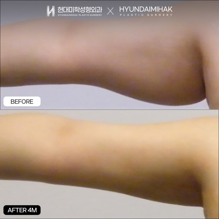 지흡가격 적정한 수준에서 효과 얻으려면