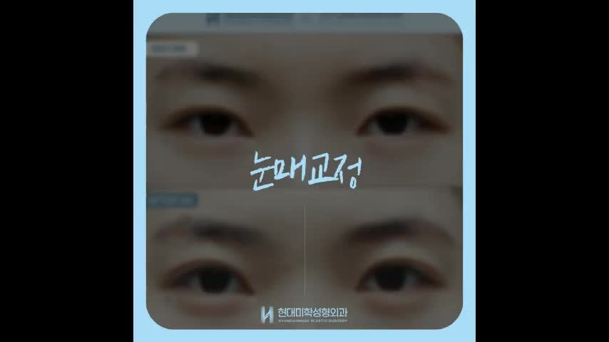 동영상