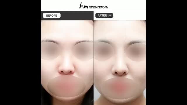 동영상