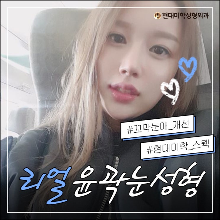쌍꺼풀잘하는곳 대박쓰대박쓰