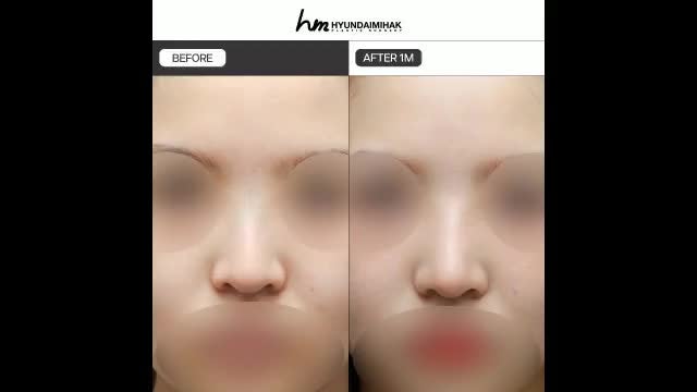 동영상