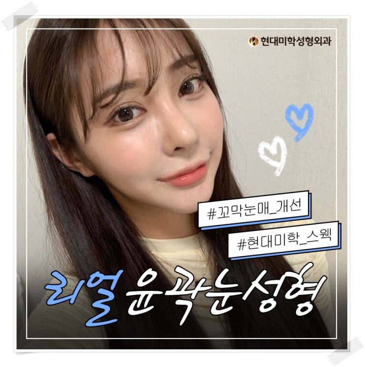 뒷트임밑트임 결과로 보여준다