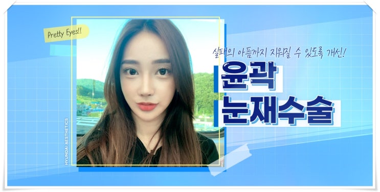 쌍꺼풀재수술잘하는병원 있긴 할까요.