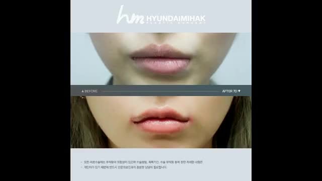 동영상