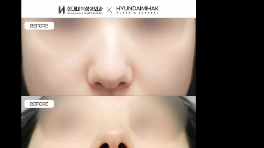동영상