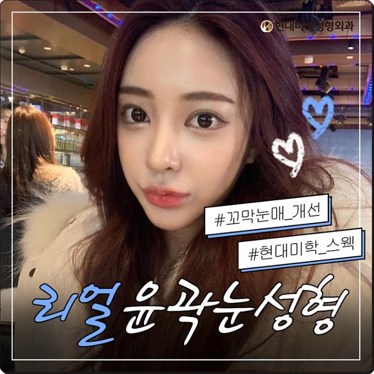 비절개눈매교정술 세련됨과 내추럴함을 동시에