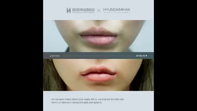 동영상