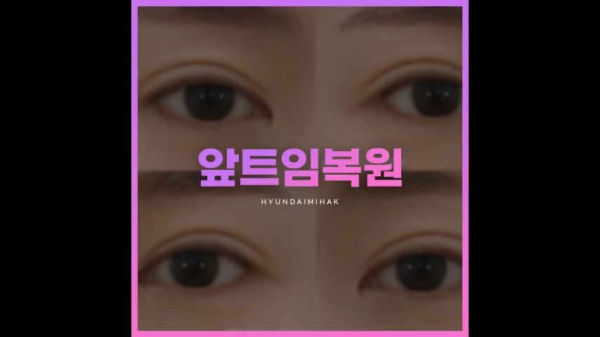 동영상