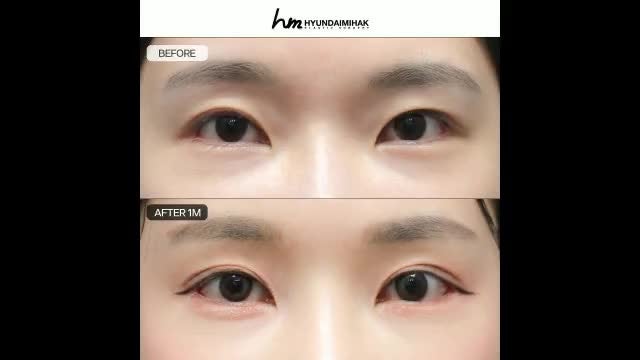 동영상