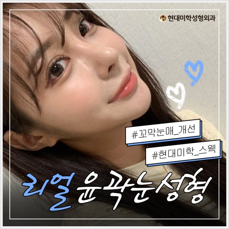 눈꼬리내리기수술 세련되게 내리자