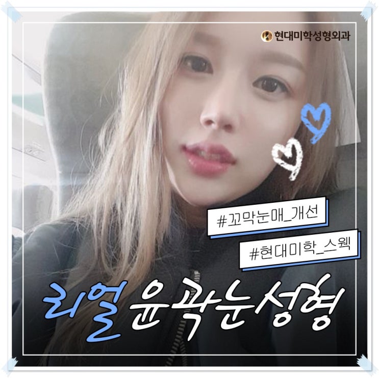 눈꼬리교정 왕누니만들기