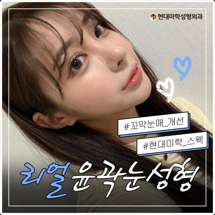 강남눈밑지방재배치 요기로요기로