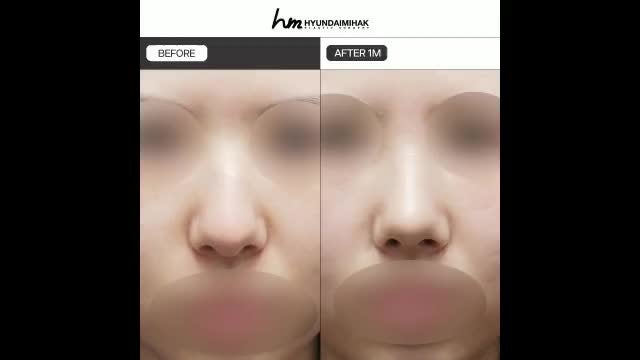 동영상