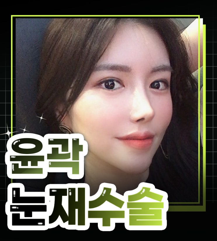 눈재수술성형외과 제대로 알아본다면