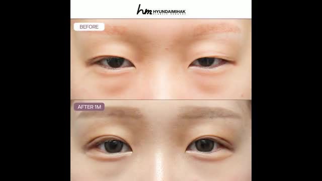 동영상