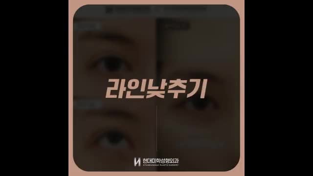 동영상