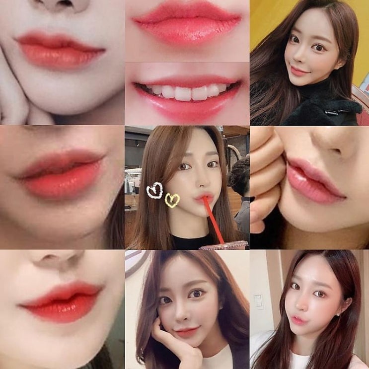 인중축소술 노안은 이제 안녕
