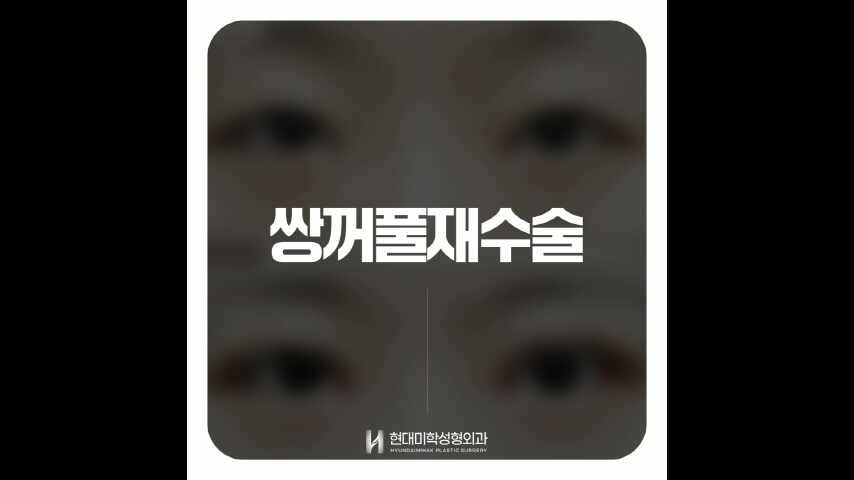 동영상