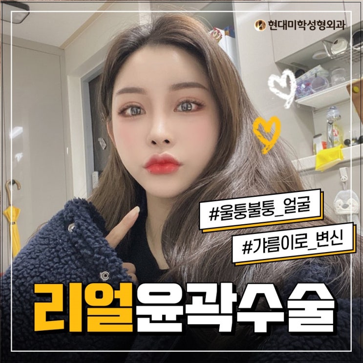 사각턱수술잘하는곳 예뻐져라yab!