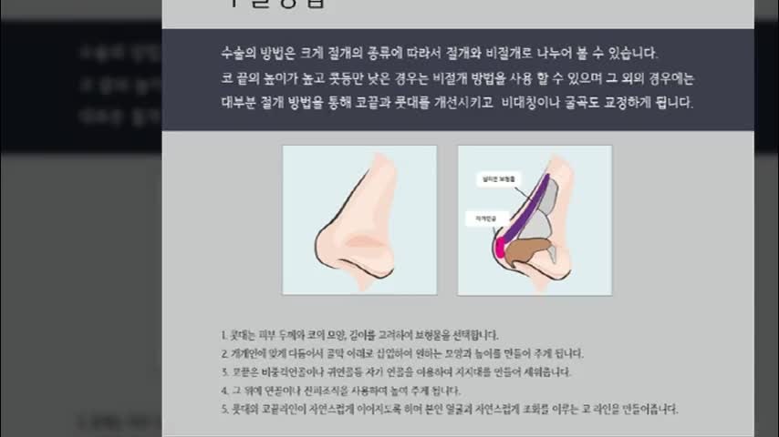동영상