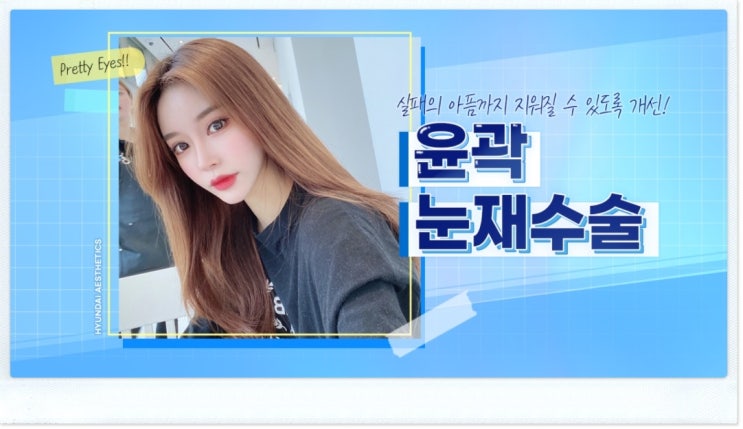 쌍수풀림 대처하는 방법이 있을까요???