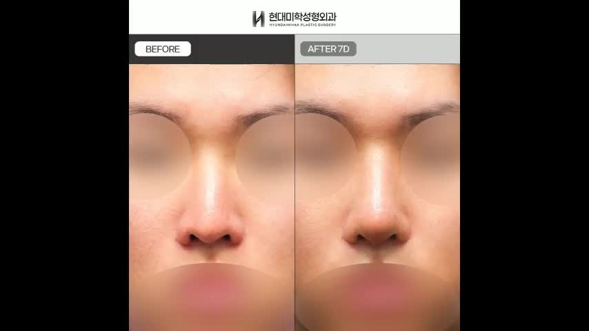 동영상