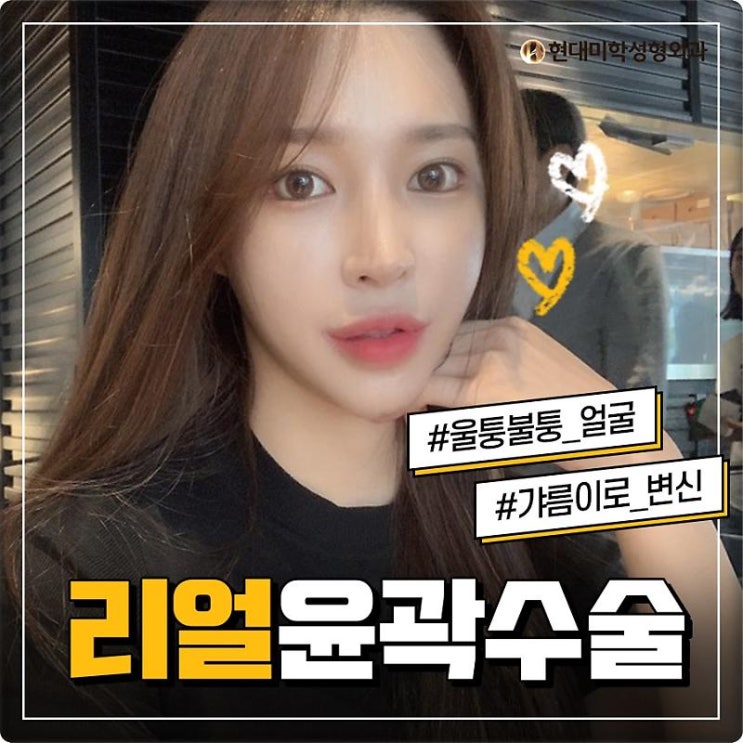 사각턱축소술 정답을 찾아라