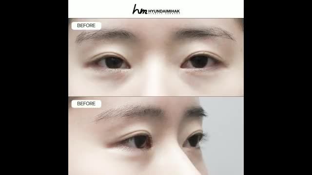 동영상