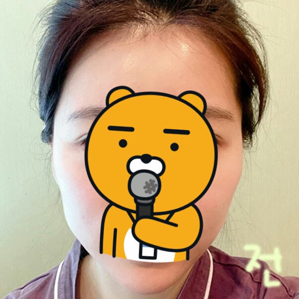 사각턱수술 후기