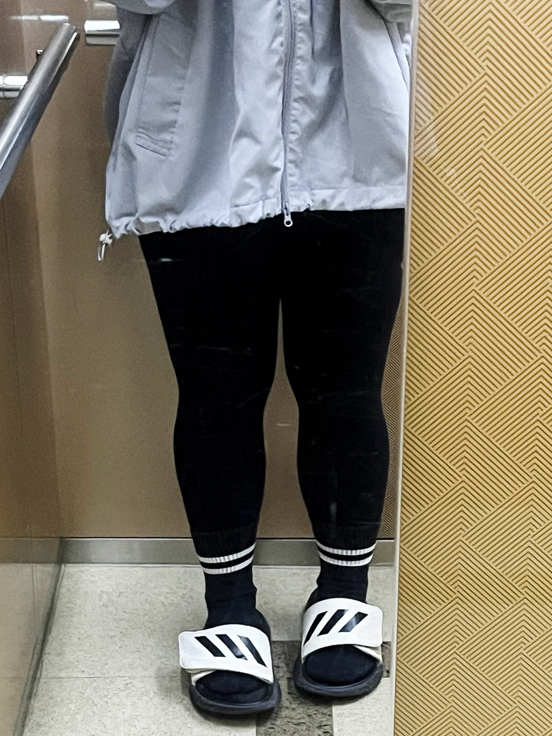허벅지지방흡입 후기