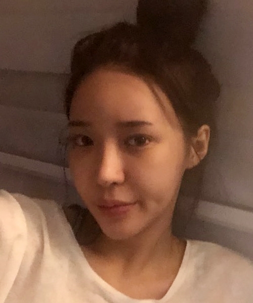 코재수술 후기
