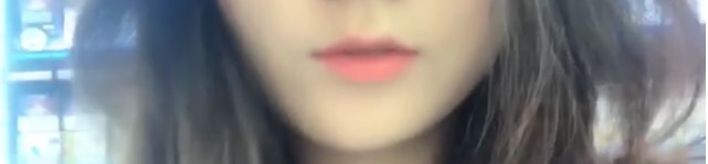 입꼬리성형 후기