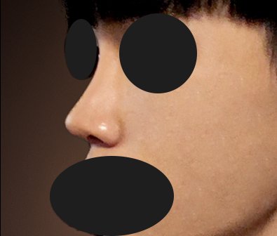 코재수술 후기