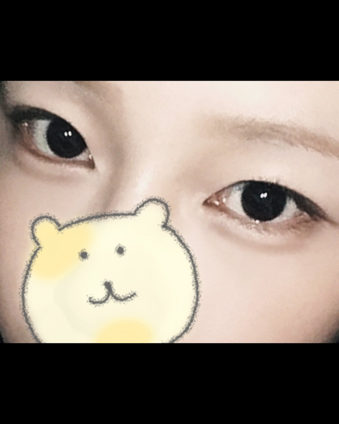 쌍꺼풀(자연유착) 후기