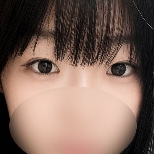 눈재수술 후기
