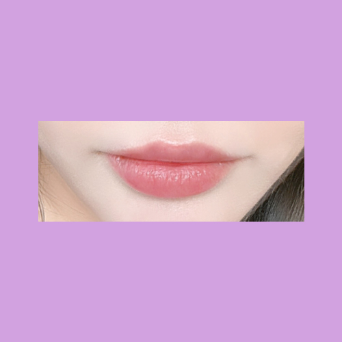 큐피트라인성형 후기