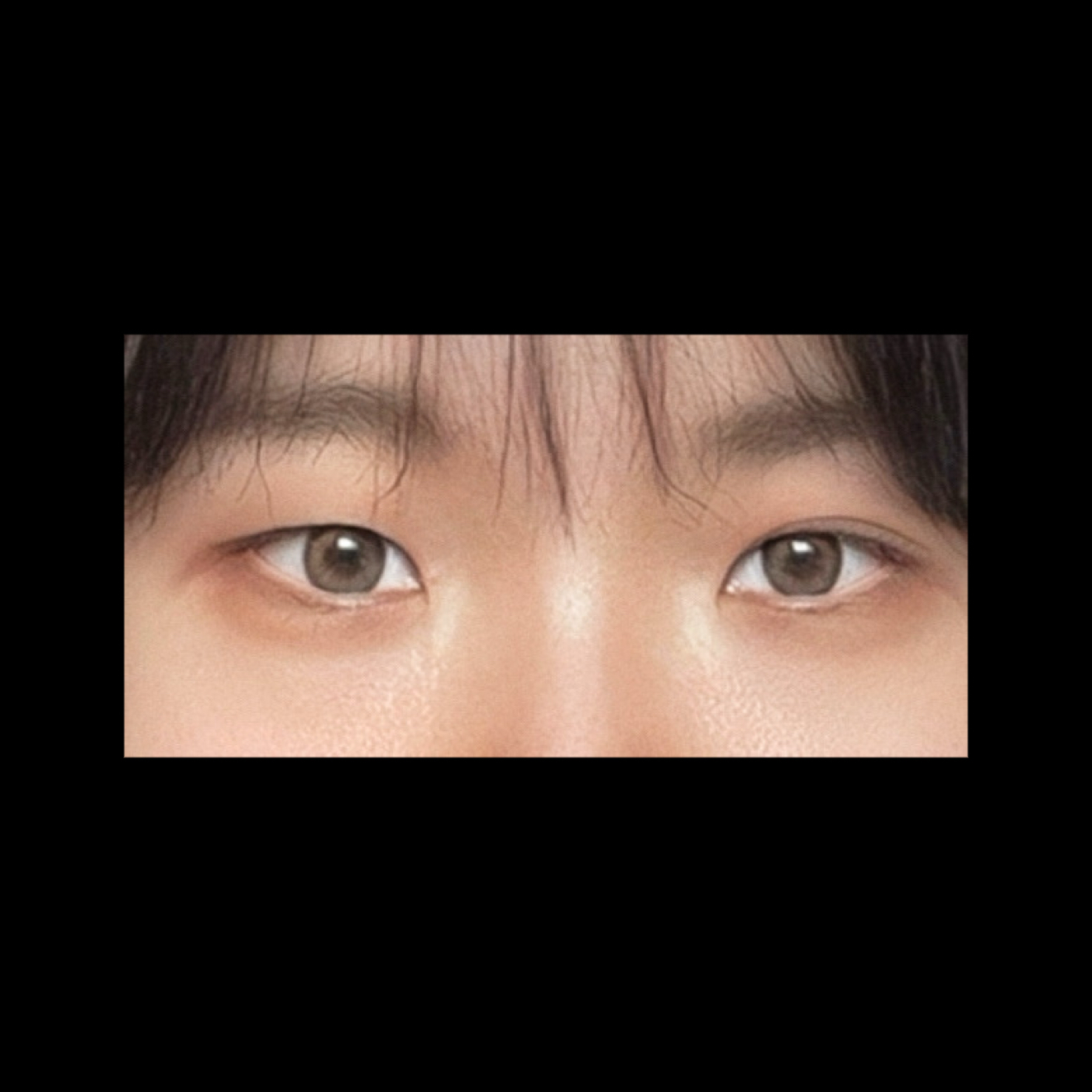쌍꺼풀(절개) 후기