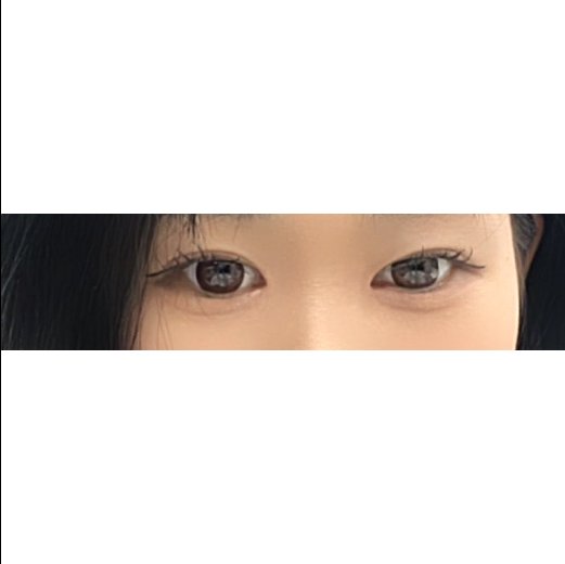밑트임 후기
