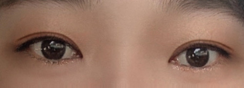 밑트임 후기