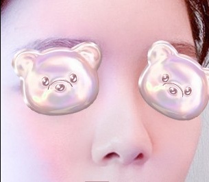 콧대(보형물) 후기