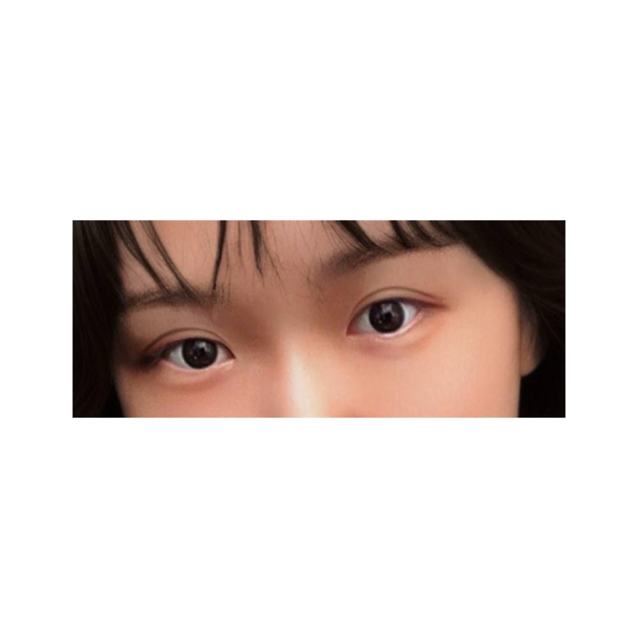 눈재수술 후기