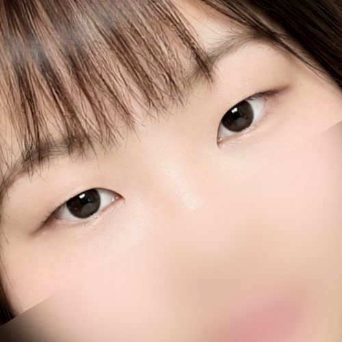 쌍꺼풀(자연유착) 후기