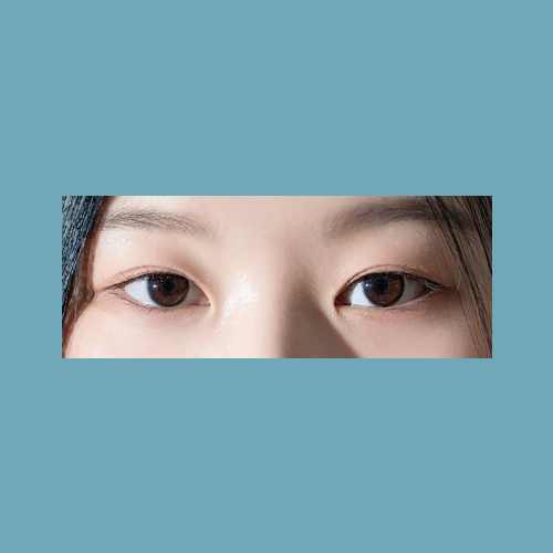쌍꺼풀(자연유착) 후기