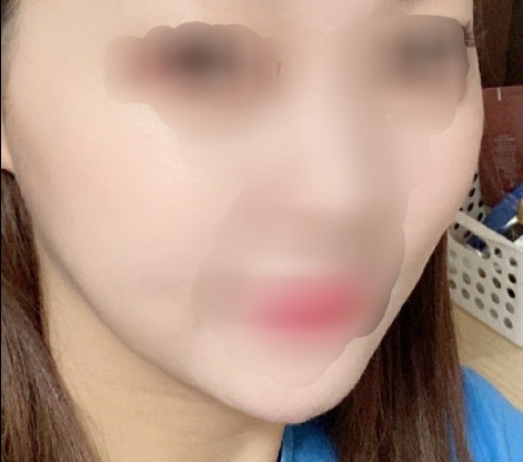 광대축소(전체) 후기