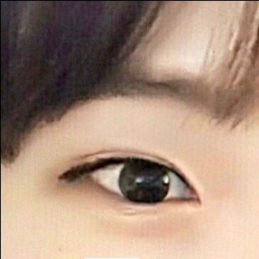 눈재수술 후기
