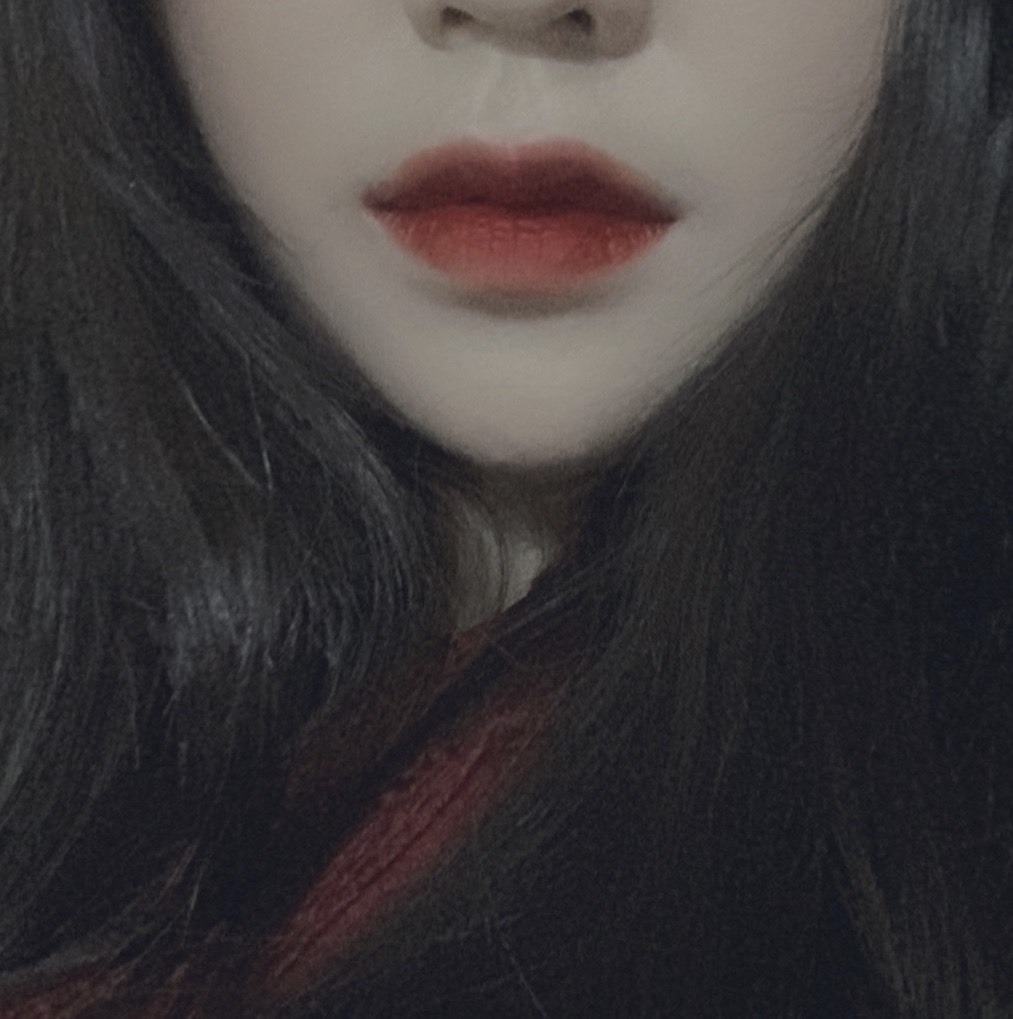 입꼬리성형 후기