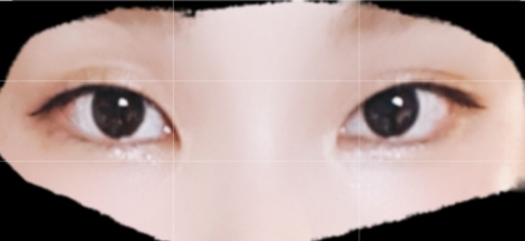 쌍꺼풀(자연유착) 후기