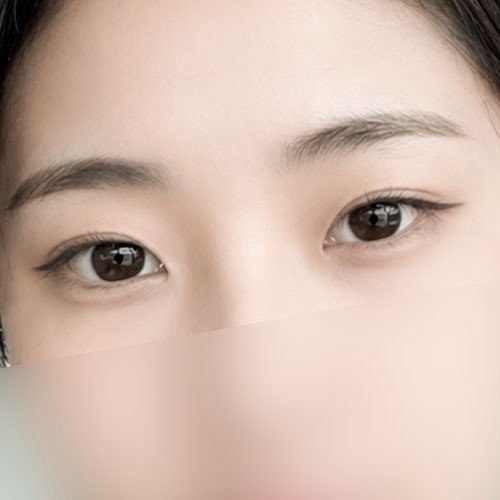 밑트임 후기