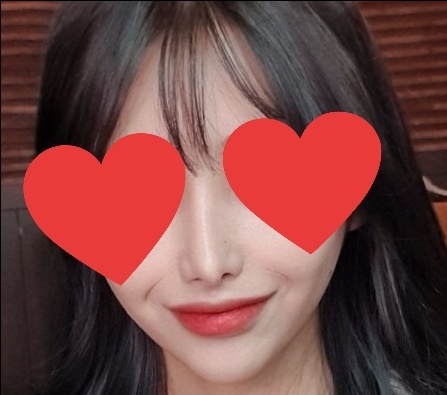 코재수술 후기