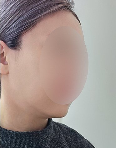 실리프팅 후기